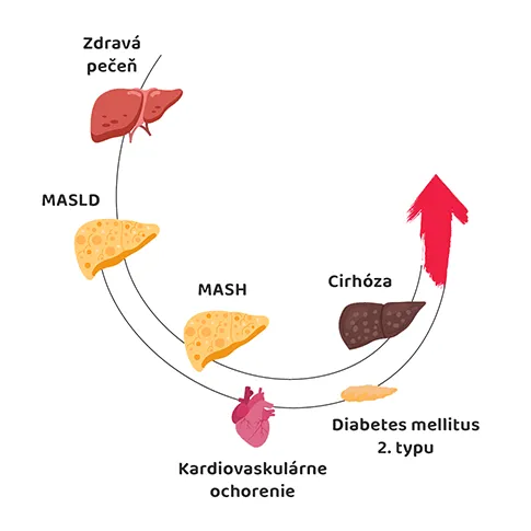 progresia pečeňového ochorenia